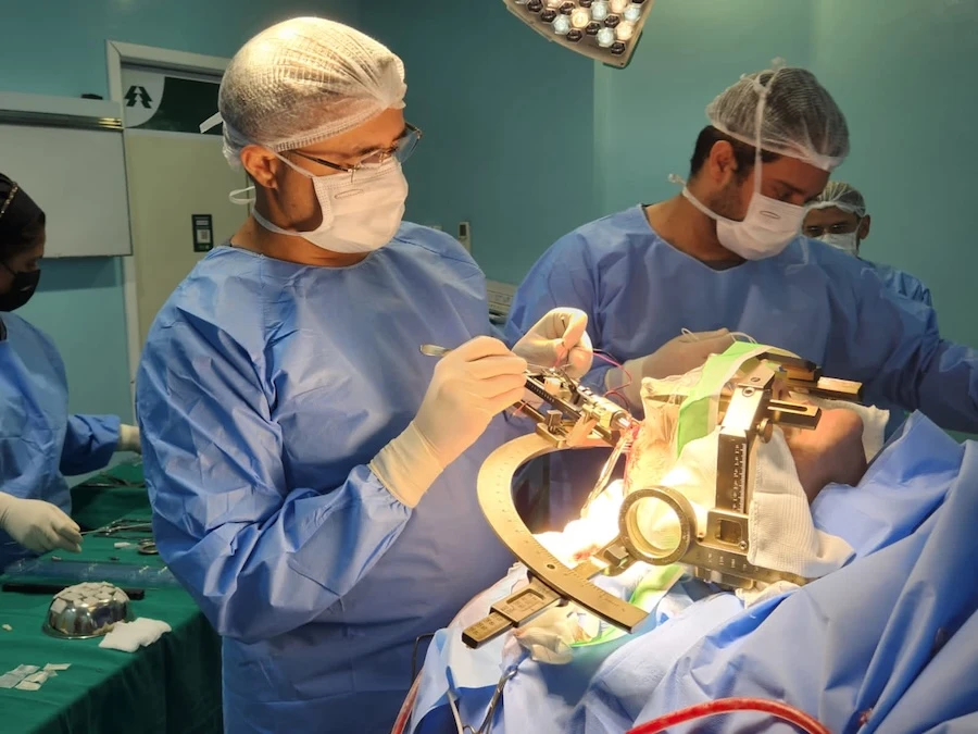 Equipe médica realizando a cirurgia DBS para Parkinson em centro cirúrgico, com paciente acordado e equipamento de estereotaxia utilizado para guiar a implantação dos eletrodos cerebrais.
