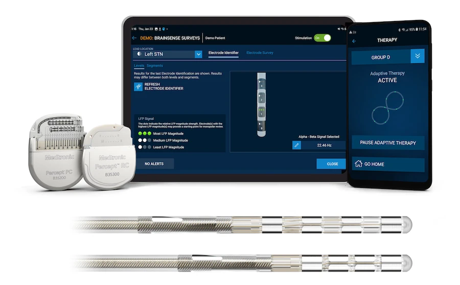 Imagem de um tablet exibindo o software de programação utilizado na cirurgia DBS para Parkinson, com interface gráfica que permite o ajuste dos parâmetros dos eletrodos cerebrais.