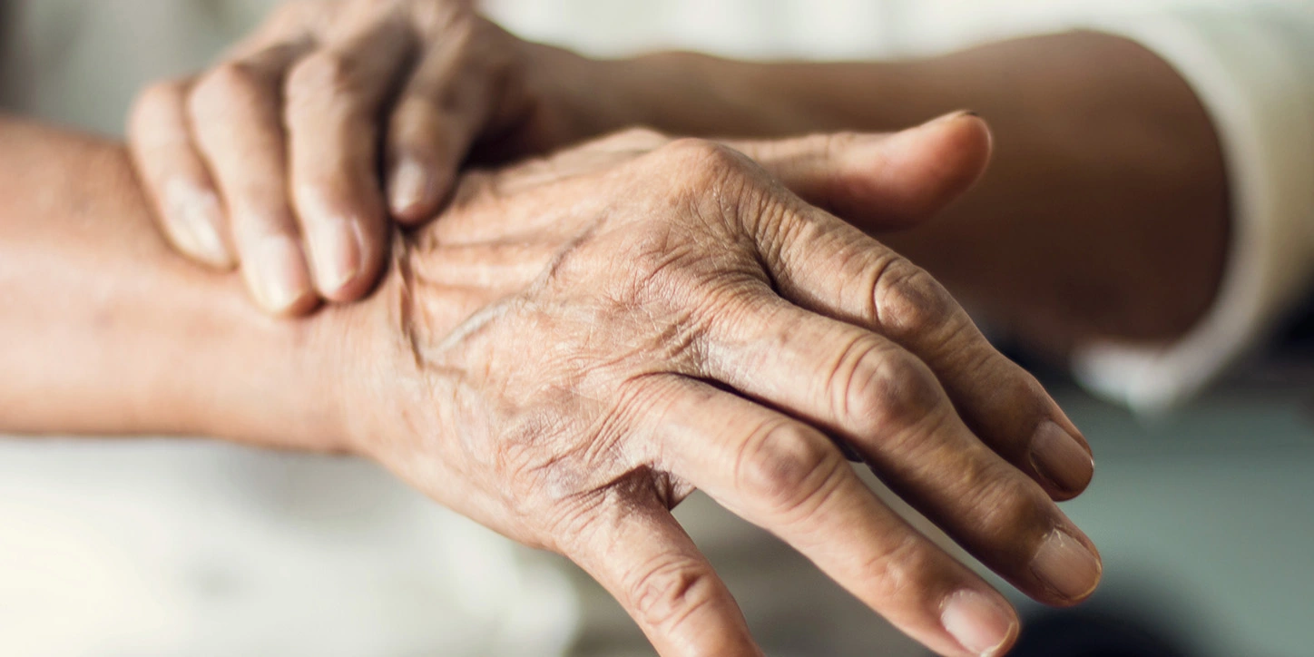 Primeiro plano das mãos de uma paciente idosa com sintomas da doença de Parkinson ou Parkinsonismo.