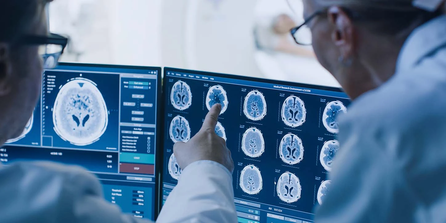 Especialistas analisando neuroimagem na Doença de Parkinson e no Parkinsonismo Induzido por Medicamentos